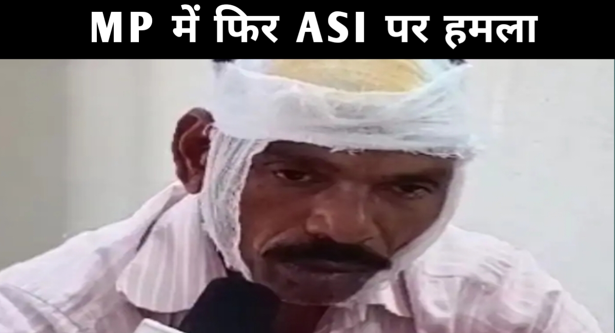 MP में पुलिस पर हमला: मामला सुलझाने गए ASI का फोड़ा सिर हालत गंभीर